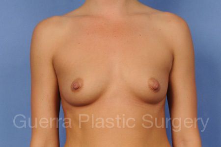 next Case #75986 Before