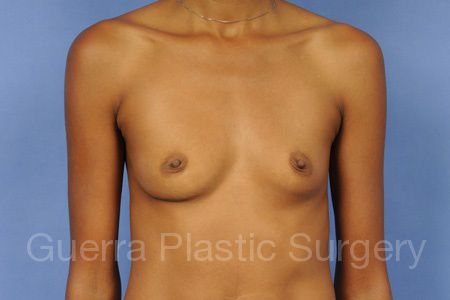 next Case #13126 Before