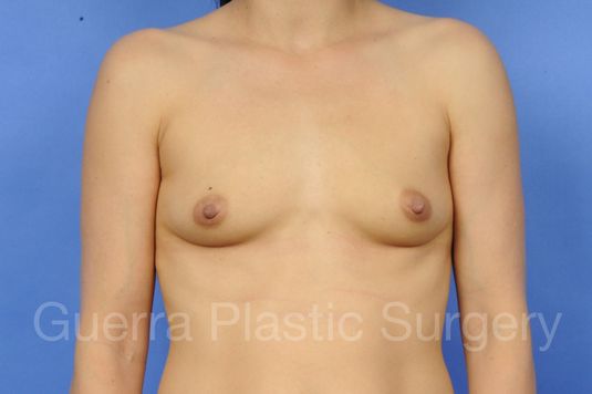 prev Case #1001008 Before