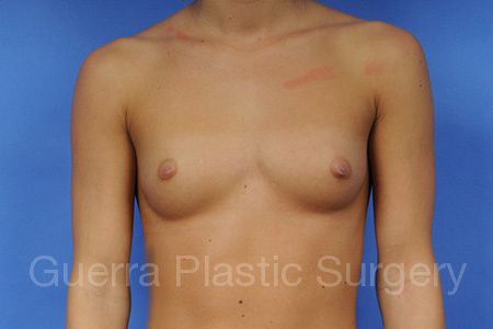 prev Case #1001026 Before