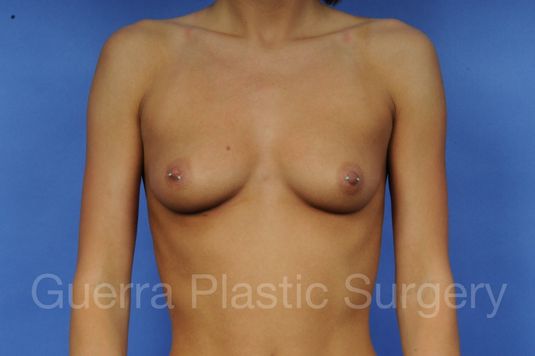 prev Case #1001041 Before