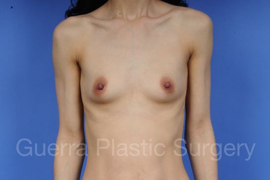 prev Case #1001045 Before