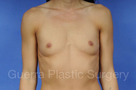 prev Case #1001046 Before