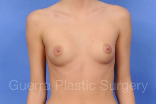 prev Case #1001067 Before