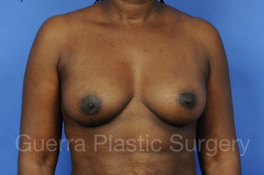 prev Case #1001071 Before