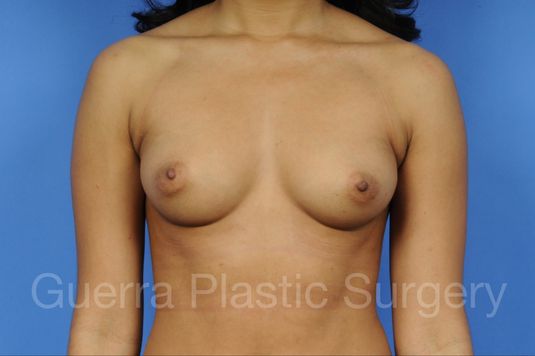 prev Case #1001079 Before