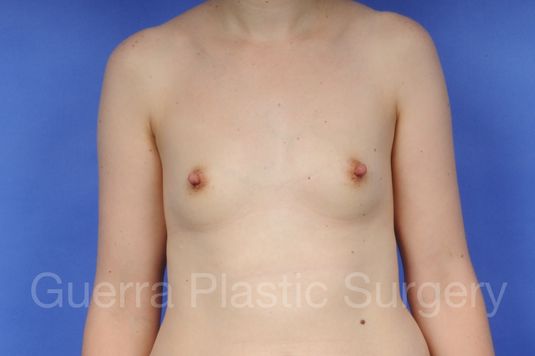 prev Case #1001089 Before