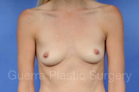 prev Case #1001091 Before