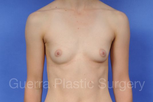 prev Case #1003007 Before