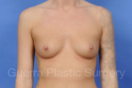 prev Case #1003013 Before