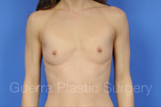 prev Case #15136 Before