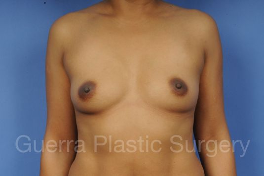 prev Case #1002003 Before