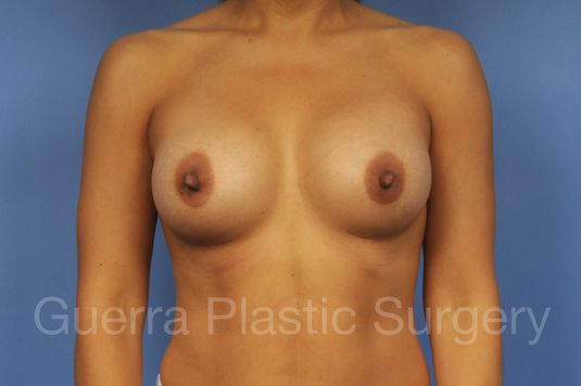 next Case #18221 After