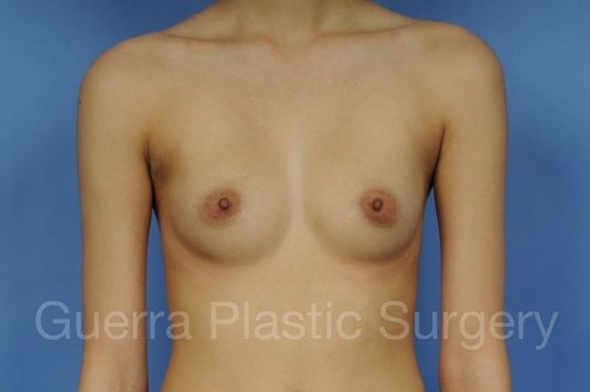 prev Case #1002015 Before