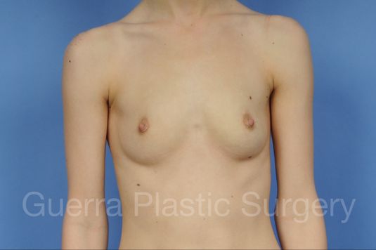 prev Case #1002007 Before