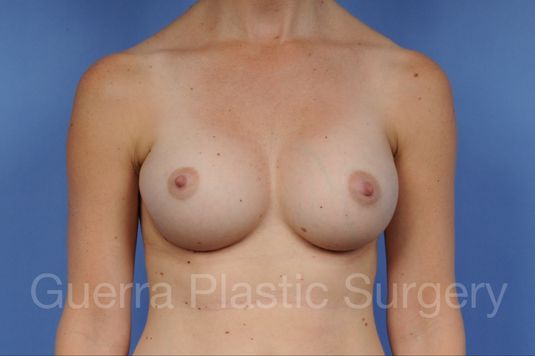 next Case #1002018 After