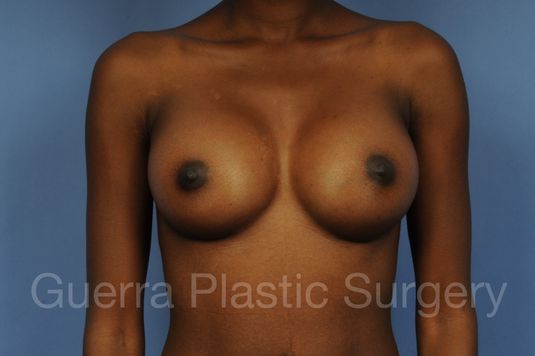 prev Case #1002021 After