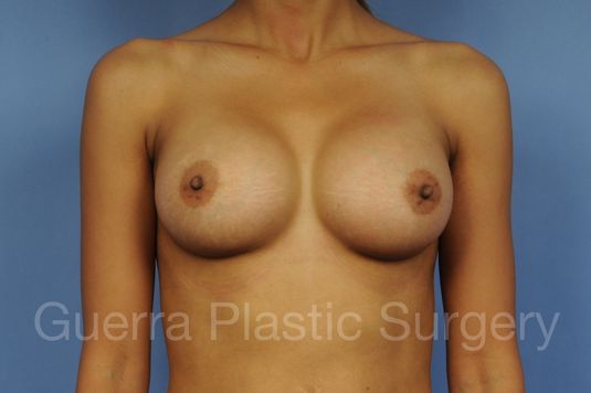 next Case #1002029 After