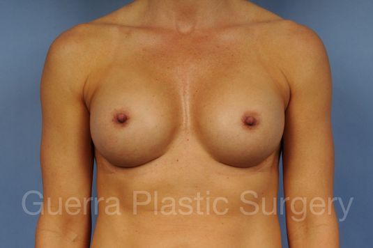 next Case #1002012 After