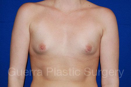 prev Case #10023 Before