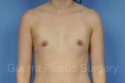 next Case #1002030 Before