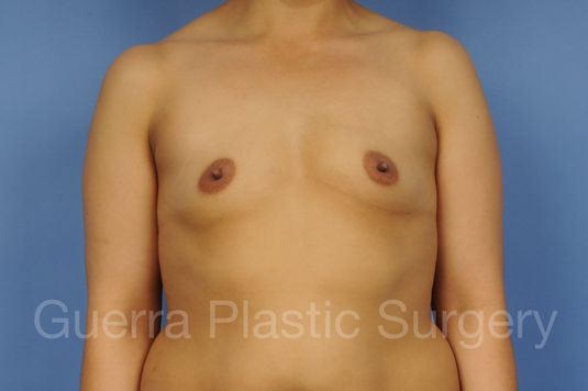 next Case #1002031 Before