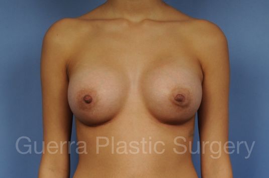 next Case #1002032 After