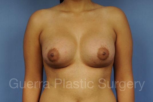 next Case #1002025 After