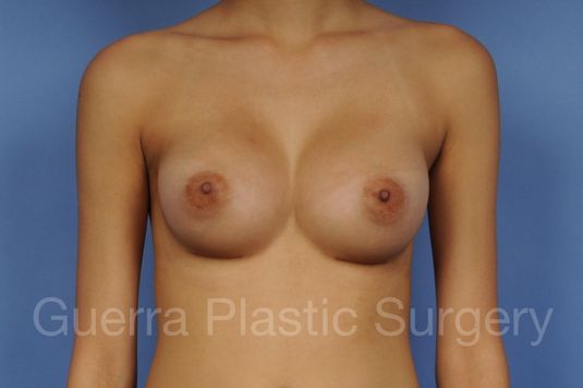 next Case #1002024 After