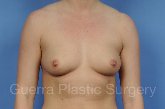 prev Case #1001093 Before