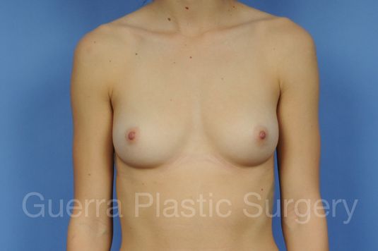 prev Case #1001094 Before