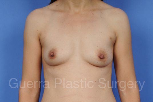 prev Case #1001109 Before