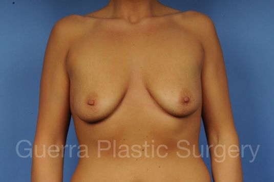 prev Case #1001112 Before