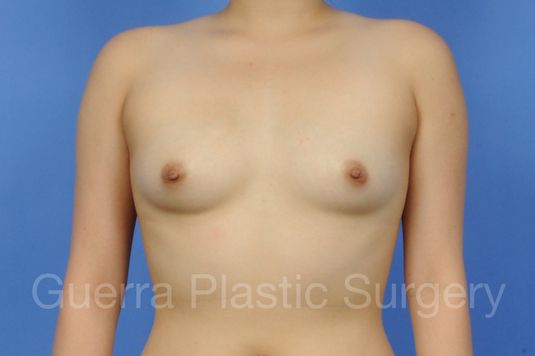 prev Case #1001118 Before