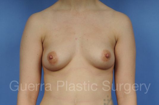 prev Case #1001119 Before