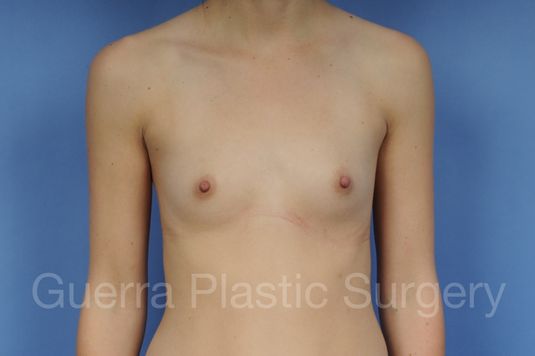 prev Case #1001123 Before