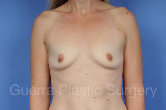 prev Case #1001127 Before