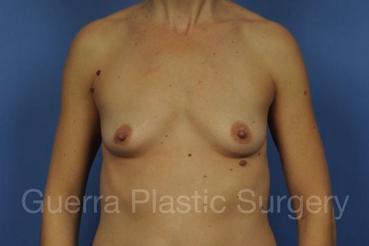 prev Case #1001134 Before