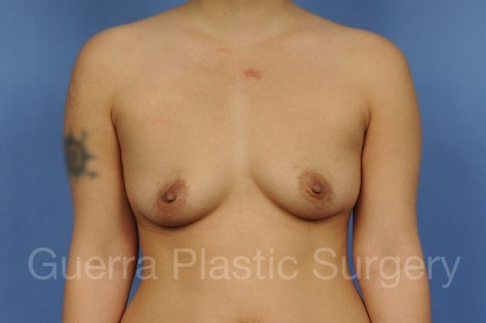 prev Case #1001137 Before