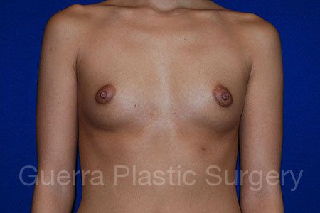 next Case #27993 Before