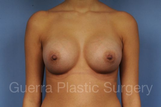 next Case #1002044 After