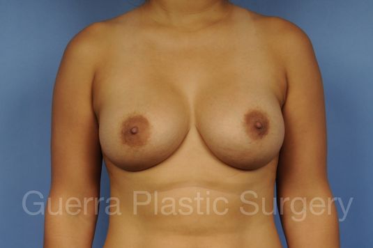 next Case #1002045 After