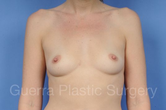 prev Case #1002049 Before