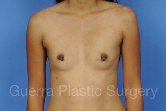 prev Case #1001146 Before