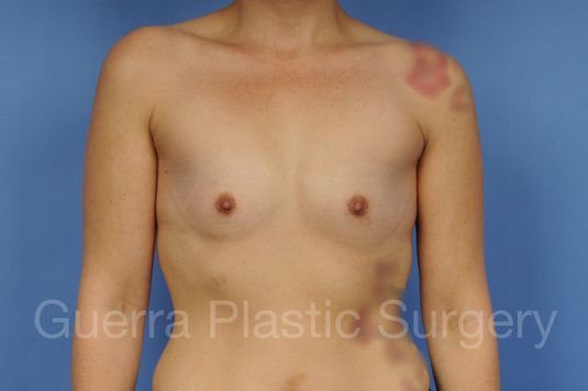 prev Case #1001149 Before