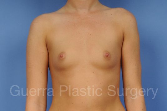 prev Case #1001151 Before