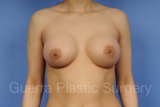 next Case #1001154 After