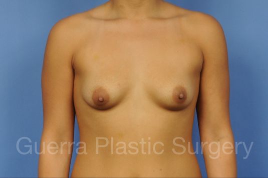 prev Case #1001158 Before