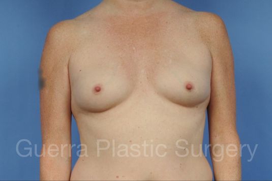 prev Case #1001163 Before