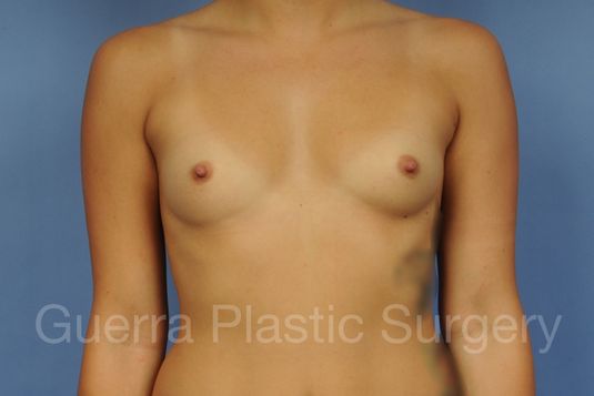 prev Case #1001165 Before